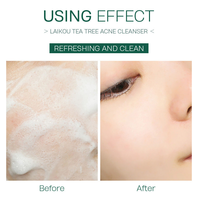 Tea Tree Facial Cleanser 50g Moisturizing Foam Facial Cleanser